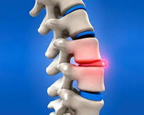 Physiotherapy for Back Pain, Edinburgh Physiotherapist, Edinburgh Physio for pain, neck pain, sports physio, massage