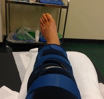 Post Op