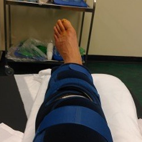 Post-Op