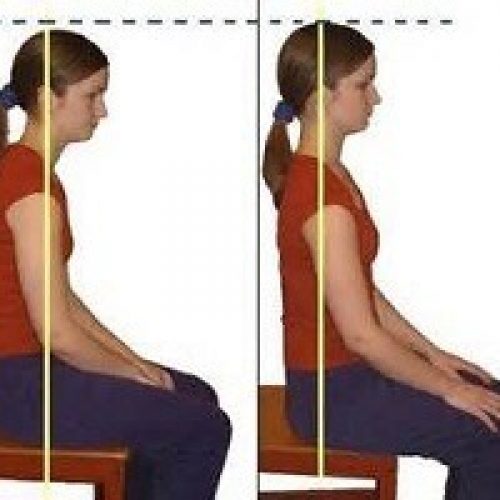 Post-sitting-posture-Physiotherapy