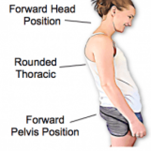 posture-e1583237609237